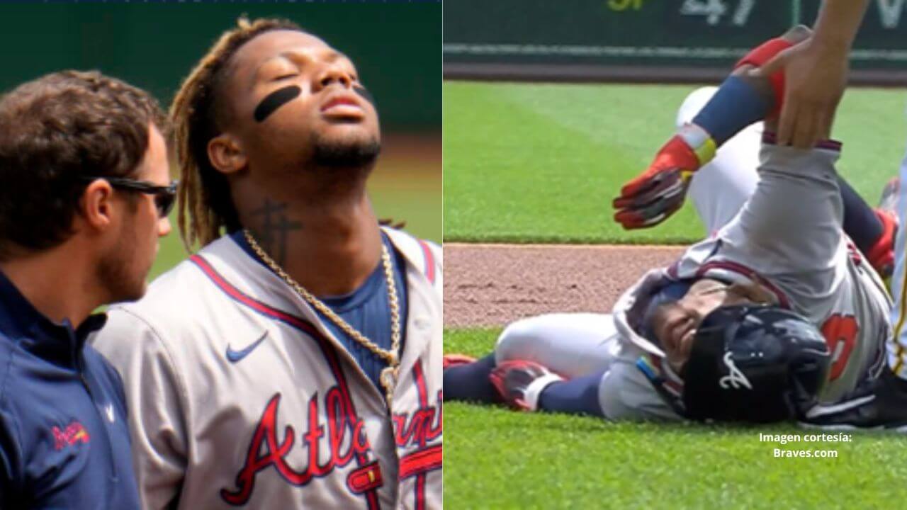 Manager de Braves reacciona tras lesión de Ronald Acuña Jr.